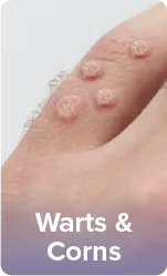 Acne breakout on facial skin showing inflamed red pimples and blemishes