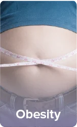 Urticaria hives on skin showing raised welts and allergic reaction marks